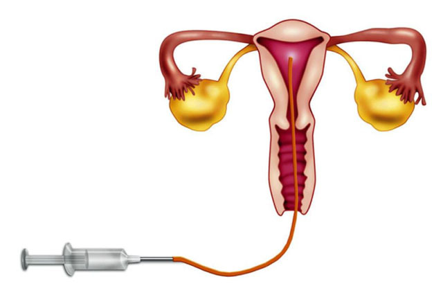 大姨妈走后别做这5件事,大姨妈刚走注意5件事