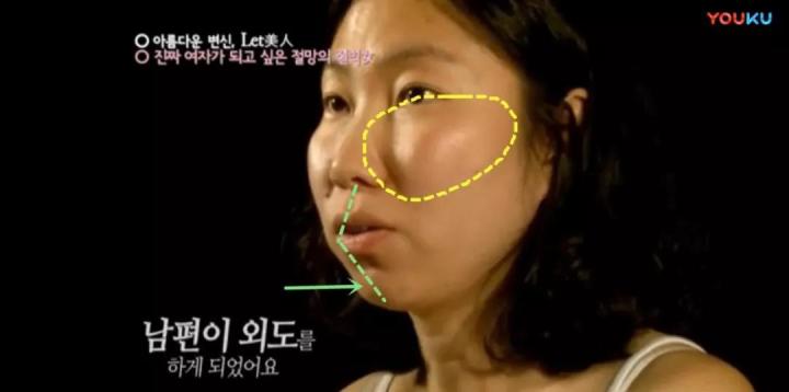 生完孩子被老公嫌弃太胖后续,生完孩子以后肚皮被老公嫌弃