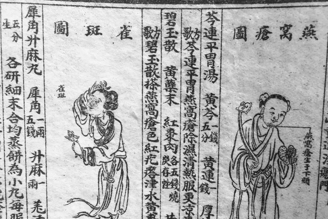 现代易容术整容技术,易容术复原面部缺陷