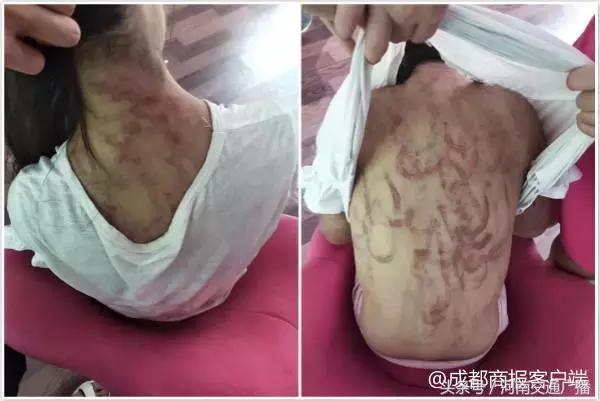 12岁女孩遭继母虐打,9岁女孩遭遇继母虐打后续