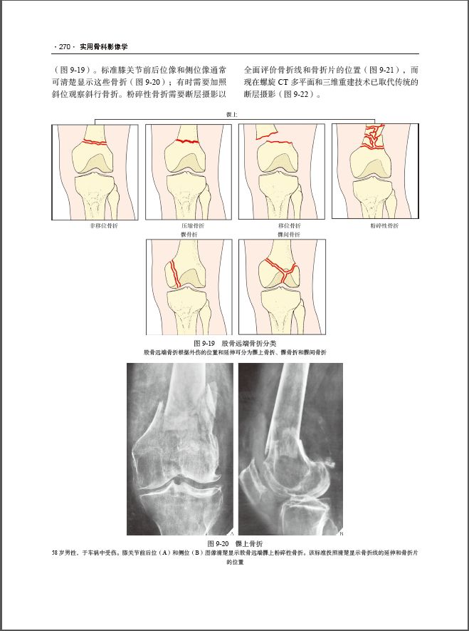 实用骨科影像学——原书第6版经典之作