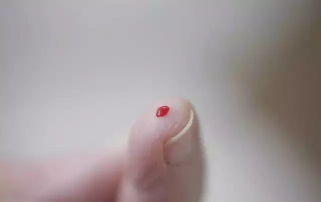 儿童磕伤快速止血方法,儿童眼部磕伤破皮怎么及时处理