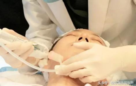 水光针打几针能改善毛孔,水光针打一次效果图