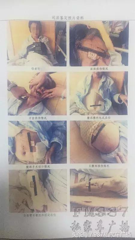 合肥滴滴顺风车事故拒赔 (福州滴滴网约车凌晨两点发生事故)