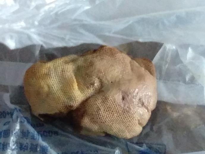 女生无麻药流产手术疼痛难忍,女性流产后腹痛里急后重