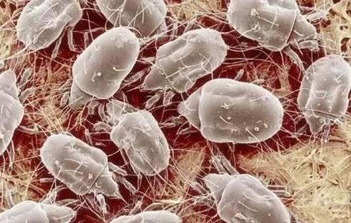 后背螨虫怎么消灭,去后背螨虫最好的方法