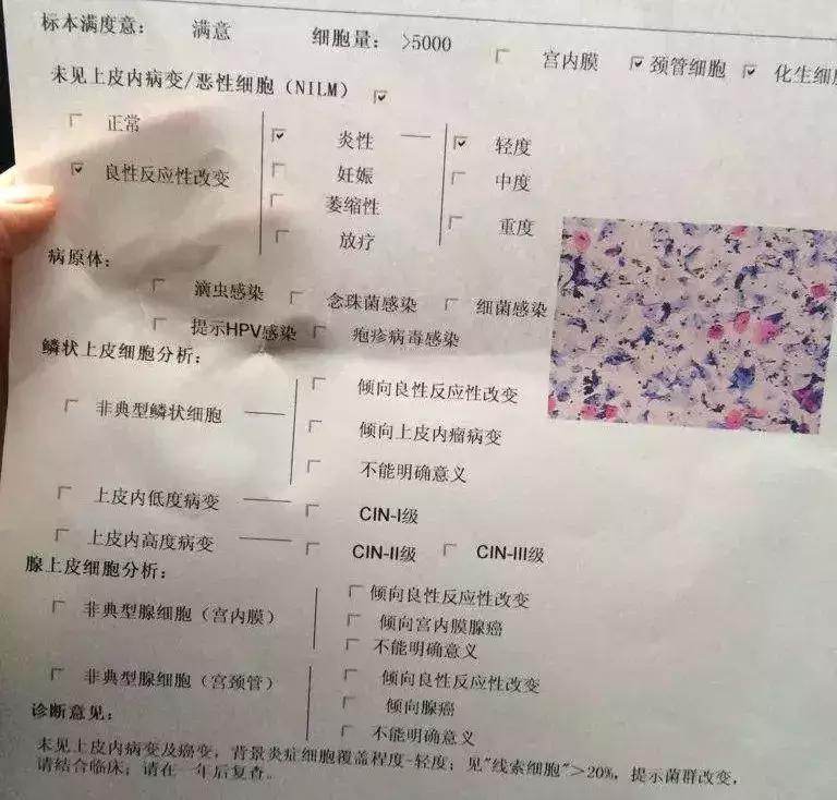 预防宫颈癌要打针,宫颈癌筛查52阳性可以打hpv疫苗吗