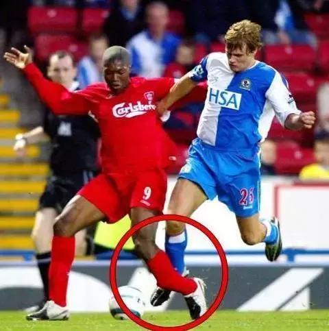 「涨知识」足球运动常见受伤后的急救处理