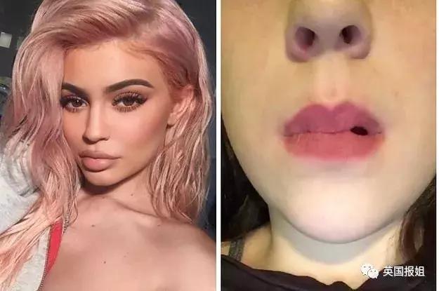 10鍏冨乏鍙崇殑moc,10鍏冪殑moc