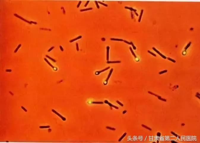 伤口感染破伤风的几率大吗,小伤口感染破伤风几率大不大