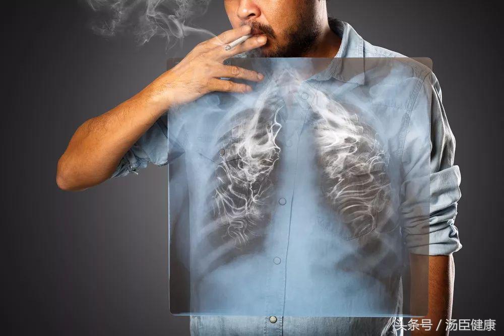 体检一切正常，4天后却癌症晚期？医生说出真相