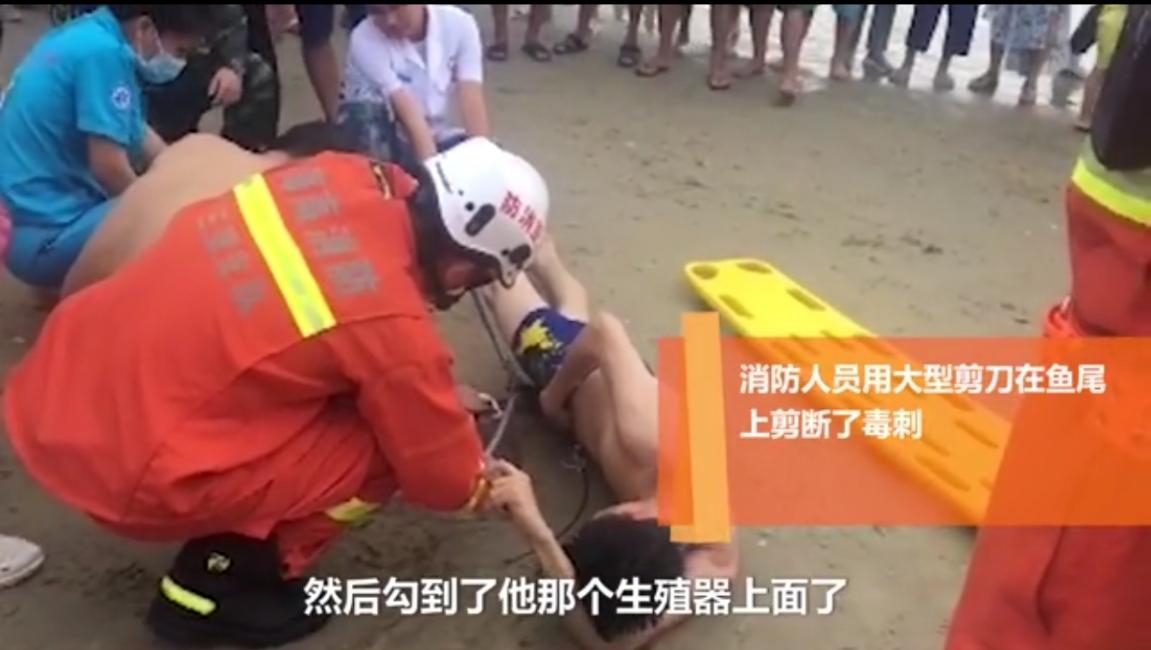 想想就很疼！魔鬼鱼刺入三亚男性游客*体下**，这是什么操作