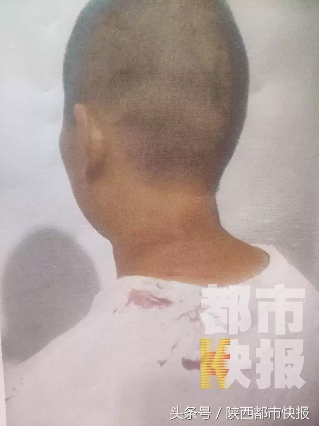 突然反目！礼泉一男子被朋友挟持到水库拘禁脱衣殴打，就因为他