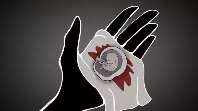 堕胎是杀人吗,堕胎就是杀生