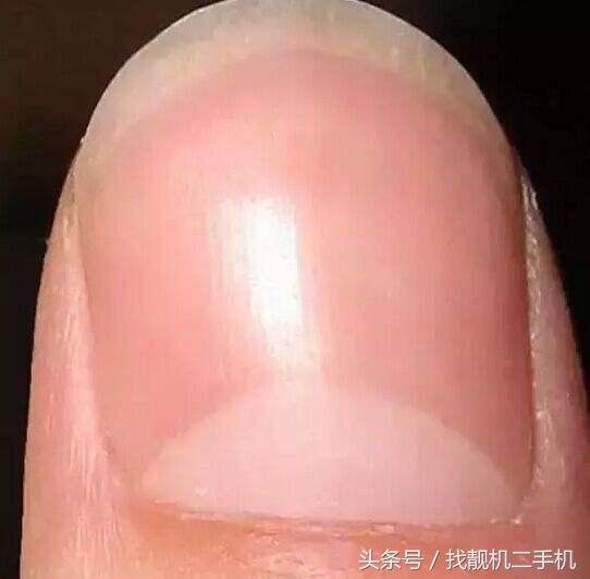 手指上没有月牙代表什么意思,十个手指都没有月牙这说明什么