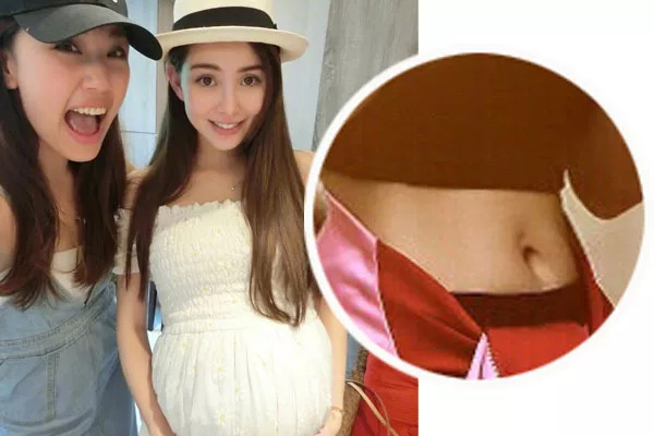 海兰最后妊娠纹恢复了么,海兰的妊娠纹怎么治好的