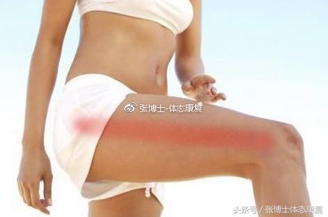 运动康复跑步膝盖疼,髂胫束摩擦综合征还能跑步吗