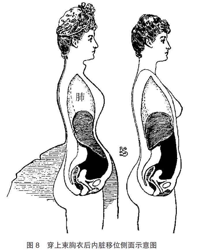 束胸衣效果展示,束胸衣显身材