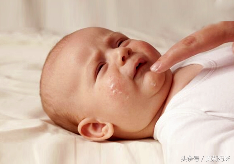 婴儿粟粒疹症状,婴儿粟粒疹越来越多怎么办