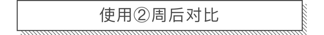 30天花80块去掉陈年老痘印到底有没有可能？