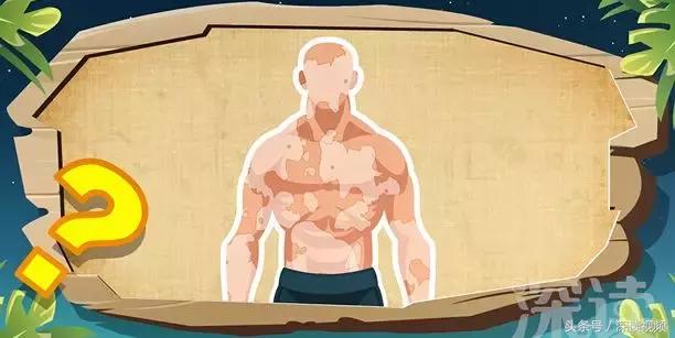 海边游泳晒红了怎么补救,海滩游泳后皮肤起红点