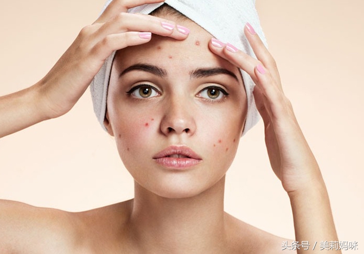 孕期长痘痘如何治好呢,孕期长痘痘有什么办法解决后背