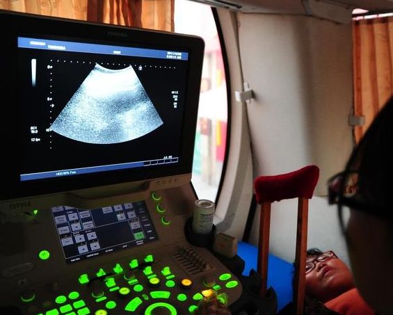 产检4维彩超需要注意什么,4维彩超能做出的畸形有哪些