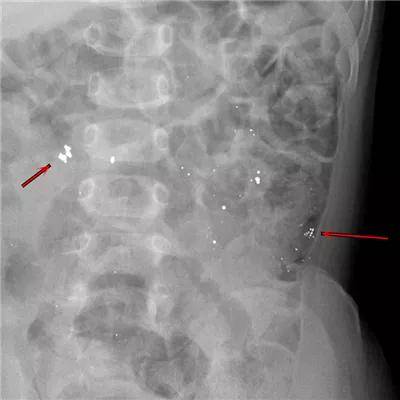 一些让人毛骨悚然拍到的照片,六个令人毛骨悚然的影像