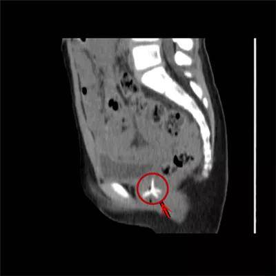 一些让人毛骨悚然拍到的照片,六个令人毛骨悚然的影像