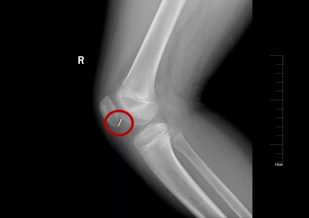 一些让人毛骨悚然拍到的照片,六个令人毛骨悚然的影像