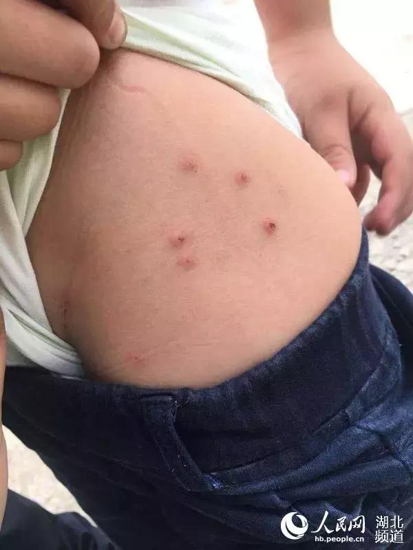 毒跑道处理结果,毒跑道