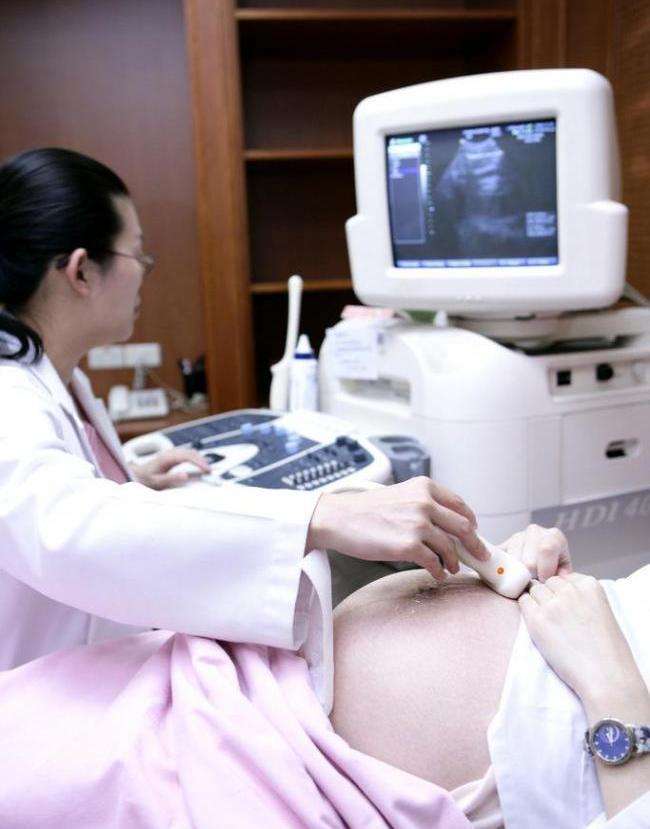 孕妇有以下4种情况就是要生了,早孕一般什么情况建议孕妇待产