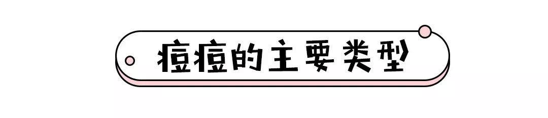 痘痘肌,痘痘肌必看五种痘痘类型