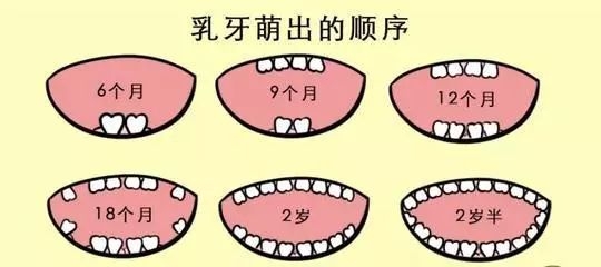 预防儿童龋齿涂氟还是窝沟封闭,有一点龋齿不想做窝沟封闭会怎样