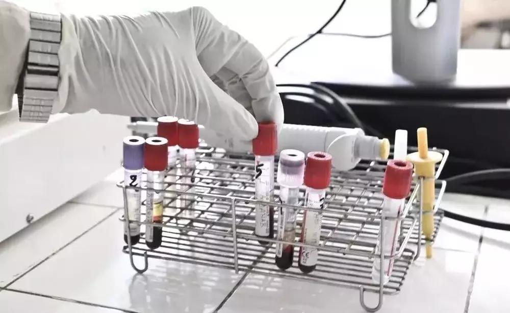 非正常死亡：夜跑路上有个变态，专挑短发长腿女孩下手