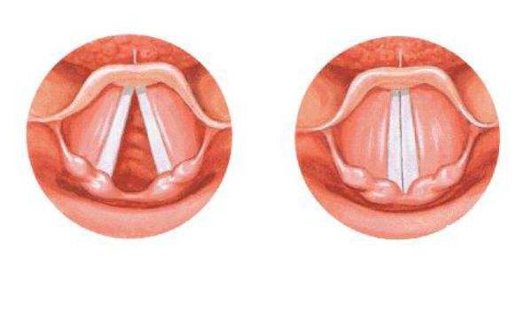 这四个部位长疙瘩当心是癌变,这4个部位有囊肿要警惕