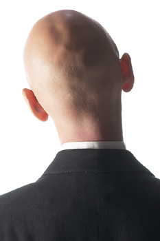 秃顶找上门中医建议不妨试试3招,秃顶中医怎么治疗最好