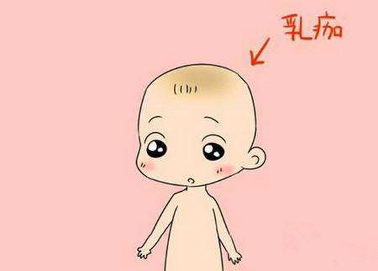 新生儿头顶上的胎垢可以清洗吗,宝宝头上的胎垢怎么清理用什么油
