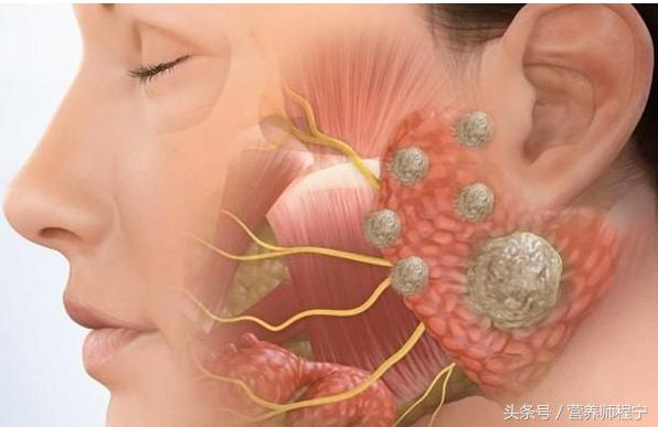 不同的部位长痘该如何解决呢,痘痘怎么才能不反复长痘