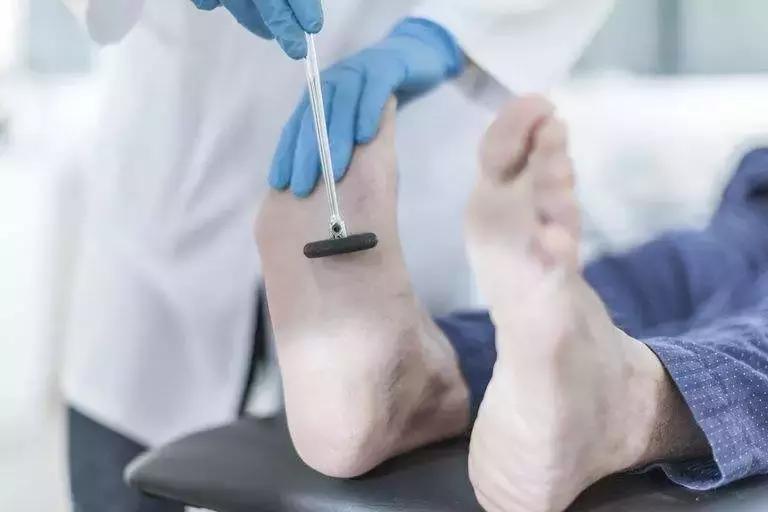 脚磨破皮不爱愈合，医生说怕是得了这种病！真希望你早点发现