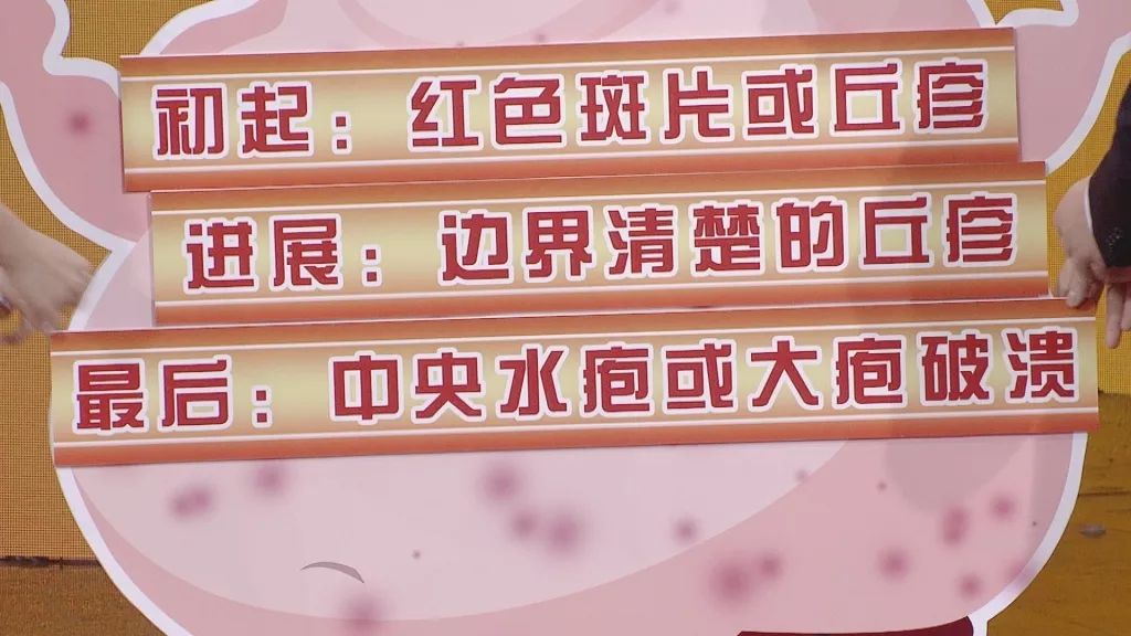 养生堂2020今天视频,养生堂讲皮肤瘙痒是哪一期