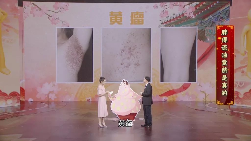 养生堂2020今天视频,养生堂讲皮肤瘙痒是哪一期