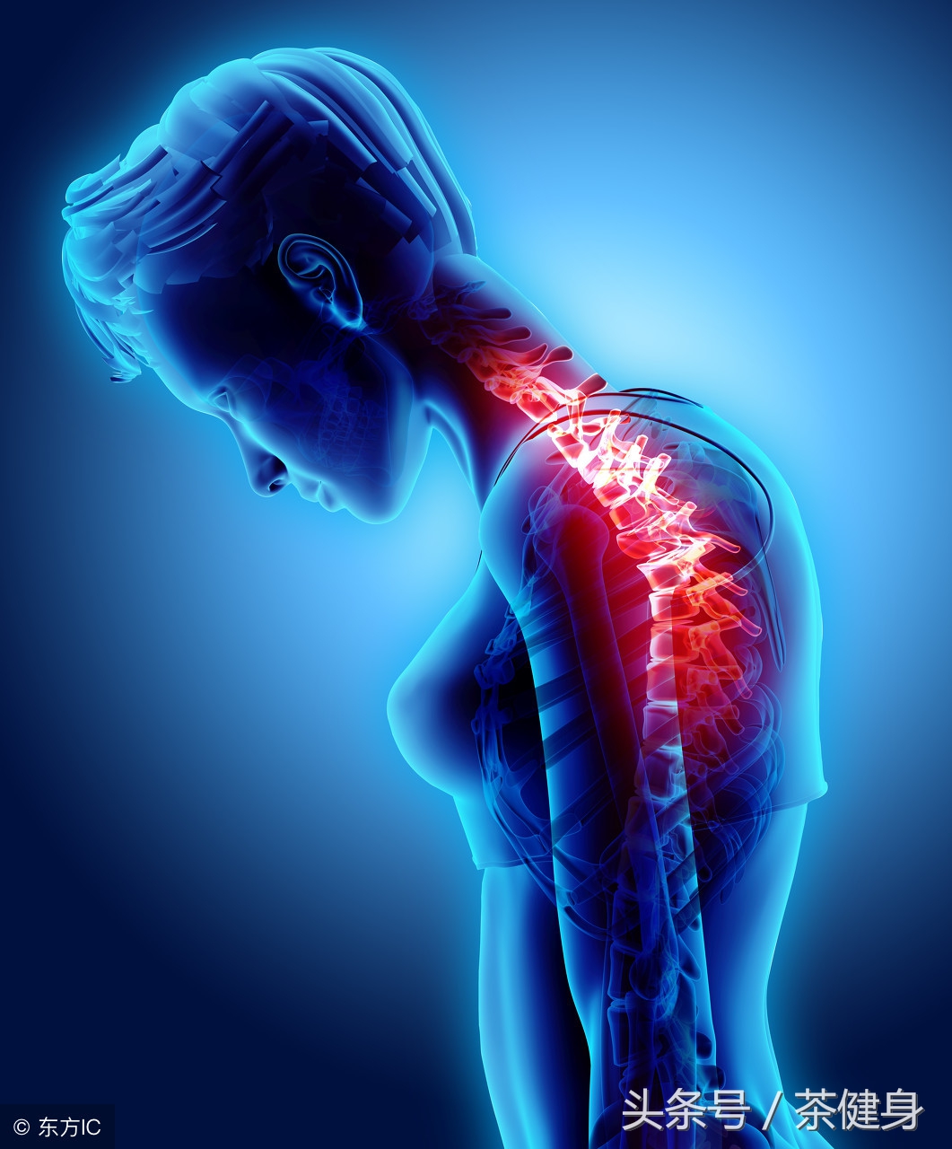 经常锻炼可以减轻偏头痛吗,有什么健身动作可缓解头痛