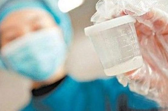 男性的“精液”若有3种表现，就偷着乐吧，说明你的生育能力很强