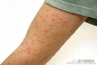 生物入侵红火蚁视频,红火蚁为什么是入侵物