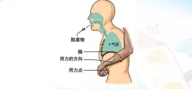 宝宝吃东西噎住的急救方法,宝宝吃东西噎住急救方法