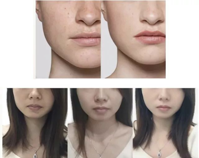 美白丸好物推荐,澳洲美白丸28天测评真实