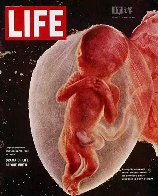 人类精子是怎么诞生的,人类进化史从精子到胎儿