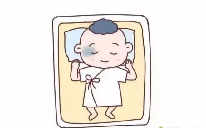 宝宝屁股上有青印,宝宝屁股上有划痕是什么情况