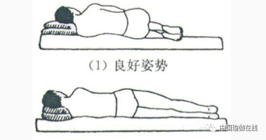 骨盆前倾练普拉提还是瑜伽,瑜伽调整骨盆前倾的体式有哪些